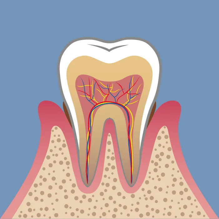 軽度歯周炎（Mild Periodontitis）