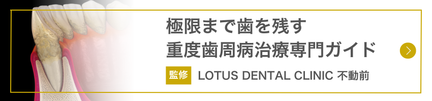 重度歯周病治療専門ガイド