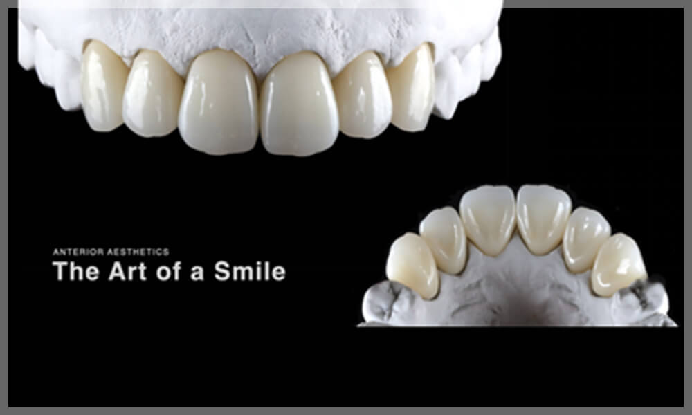 ANTERIOR AESTHETICS The Art of a Smile