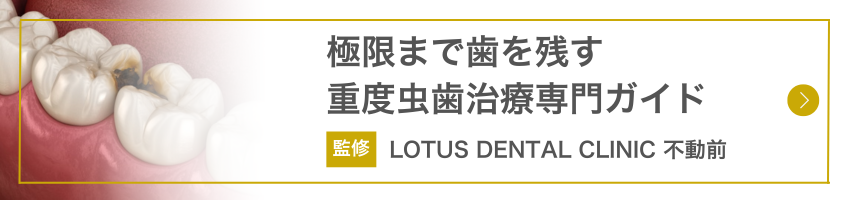 重度虫歯治療専門ガイド