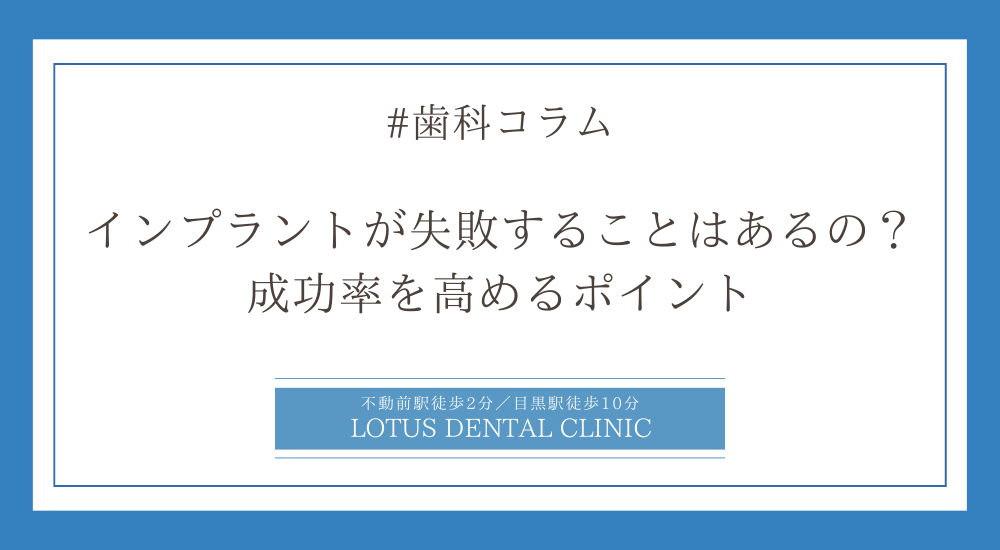 インプラントが失敗することはあるの？成功率を高めるポイント