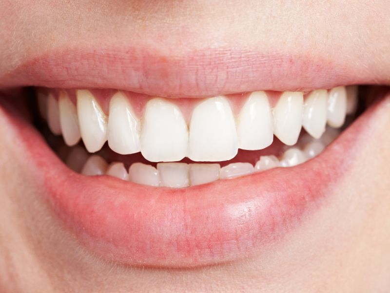 あなたの笑顔、もっと素敵にできる ― 審美歯科の第一歩