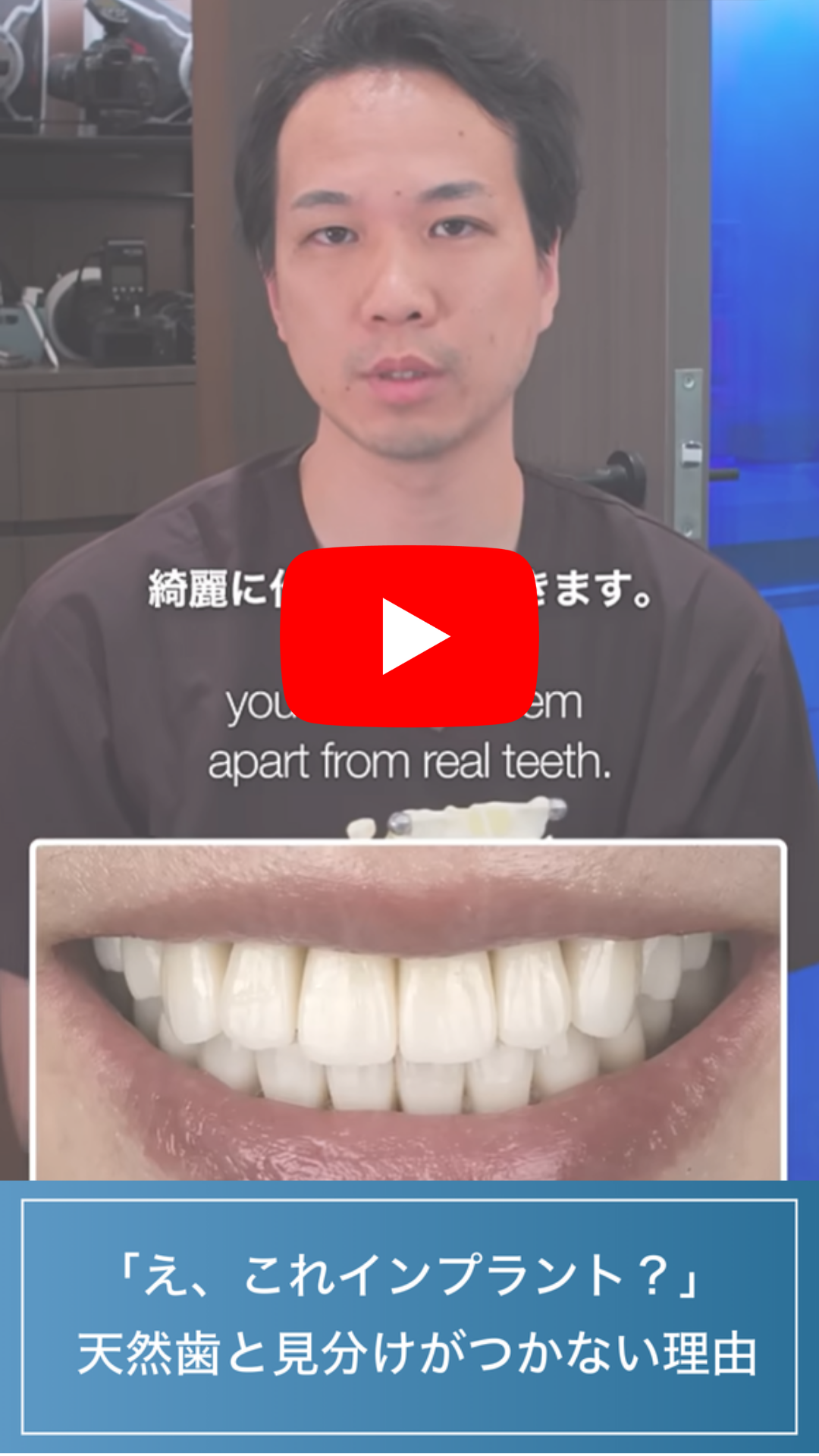 天然歯との見分け