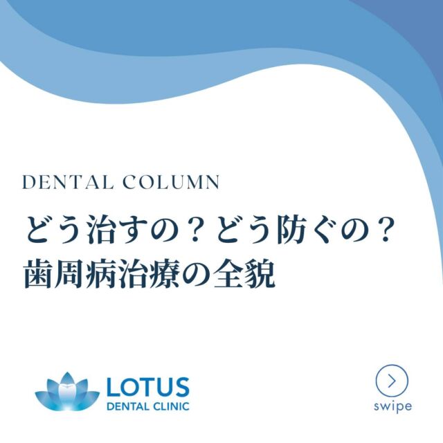 【　どう治るの？どう防ぐの？歯周病治療の全貌　】

LOTUS DENTAL CLINICです🦷🍃

　
🦷 治療＋予防で「未来の健康」を守る

LOTUS DENTAL CLINICは、歯周病治療を通じて、健康で快適な生活をサポートします。
私たちのアプローチは、ただの「治療」ではなく、予防と再発防止を重視。
将来の健康まで見据えたケアを提供します。

　
＝当院の歯周病治療の流れ＝

STEP 1️⃣ カウンセリング
初診時には、患者さん一人ひとりの生活背景やお口の状態に寄り添った“対話”重視のカウンセリングを実施します。
「どんな治療が必要か？」だけではなく、「どんな未来を目指したいか？」を共有し、治療方針を一緒に作り上げます。

STEP 2️⃣ 精密検査
最新設備を活用し、目に見えない部分まで徹底的に診断します。
🔍 CTスキャンで骨や歯根の状態を3Dで確認
📸 口腔内写真で視覚的にわかりやすい説明を提供
患者さん自身にも治療の必要性をしっかり理解していただけるよう努めます。

STEP 3️⃣ 治療計画のご説明
精密検査の結果を元に、
「短期的な治療」と「長期的な予防」を両立したプランを作成します。
✨ ライフスタイルに合わせた無理のない治療提案
✨ 患者さんの「選ぶ力」を尊重した治療オプションの提示

STEP 4️⃣ クリーニングと基本治療
「歯石を取るだけ」ではありません！
歯周病の根本原因であるバイオフィルムを徹底的に除去し、再発しにくい環境を整えます。
🪥 自宅でのケアのコツも丁寧にレクチャー。
セルフケアも含めたトータルサポートで治療の効果を最大化します。

STEP 5️⃣ 歯周外科治療（再生治療）
「高度な技術」で失われた歯周組織を再生。
患者さんのお口の機能と見た目を取り戻すため、専門性の高い治療を提供します。
🛠️ 骨再生治療や特殊な外科治療も対応

STEP 6️⃣ メインテナンス
「治療が終わり」ではなく、「予防が始まり」
🌟 継続的なフォローアップで未来の健康を守る
🌟 患者さんに寄り添う定期メインテナンスプログラム
1～3ヶ月ごとのチェックで、安心して治療後の生活を送れるサポートを徹底します。

　
LOTUS DENTAL CLINICは、
「治療で終わらない歯周病治療」を提供します。
🦷 お口の健康は、全身の健康につながる大切な鍵です。

少しでも気になる症状がある方は、ぜひご相談ください🍀

　
📍 アクセス
〒141-0031 東京都品川区西五反田3丁目13-11
不動前駅徒歩2分、目黒駅徒歩10分
首都高環状線「五反田出口」すぐそば

#Lotusdentalclinic 
#品川区 #不動前 #武蔵小山
#歯科 #歯医者 #歯科医院
#歯科医師 #歯科衛生士 #歯科助手
#歯周病 #歯周病予防 #歯周病治療　#歯周病が気になる
#歯を守る #まもるつくる再生する #健口と健康
#生活に寄り添う治療 #選べる治療プラン #未来の健康を守る
#お口の健康は全身の健康 #健康寿命 #トータルケア