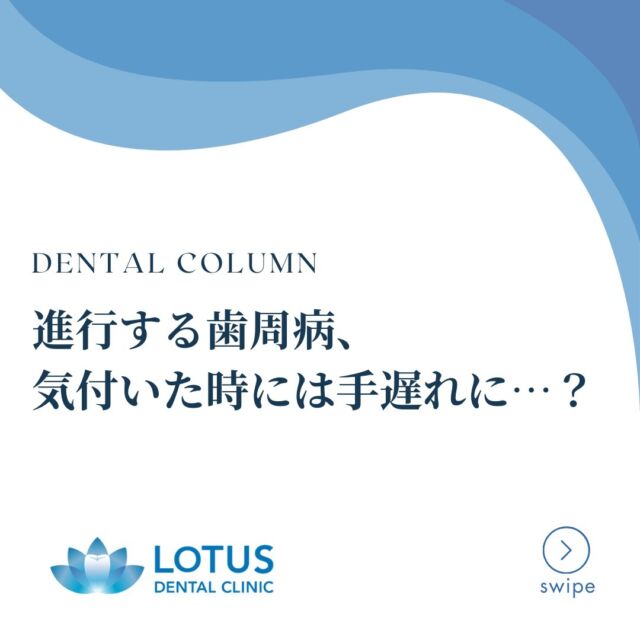 【進行する歯周病、気づいたときには手遅れに…？】

LOTUS DENTAL CLINIC 不動前です🦷🌿

　

💡 歯周病の進行とそのリスク 💡

歯周病は、初期段階では自覚症状がほとんどありません。しかし、進行するにつれて歯ぐきや骨に大きな影響を及ぼします。以下に歯周病が進行する過程と、その影響について詳しく説明します。

　

🔍 歯周病の進行ステージ 🔍

STEP 1️⃣ 歯ぐきの炎症（初期段階）
プラークや歯石の影響で歯ぐきが赤く腫れ、ブラッシング時に出血することがあります。
⚠️この段階での治療が非常に重要です。

　

STEP 2️⃣ 炎症が骨に広がる（中期段階）
歯ぐきの炎症が進み、歯を支える骨（歯槽骨）が溶け始めます。症状として以下が現れます。

✔ 歯ぐきが腫れる
✔ 口臭が気になる
✔ 歯がグラつく感覚

　

STEP 3️⃣ 骨の破壊が進行（重度段階）
歯槽骨の2/3以上が溶けると、歯を支える力がなくなり、以下のような深刻な症状が出ます。

✔ 歯が大きく動揺する
✔ 歯ぐきから膿が出る
✔ 強い痛みが発生する

この段階では、抜歯が必要になることも少なくありません。

　

🔧 歯周病治療で可能なこと 🔧

「治療が遅れても諦めないで！」
LOTUS DENTAL CLINICでは、重度の歯周病にも対応できる再生治療を提供しています。失われた歯槽骨や歯ぐきを取り戻し、歯の安定性を改善する可能性があります。

✨ 骨再生治療
✨ 歯周外科治療

再生治療は個々の症例に応じた計画が必要なため、専門的な診断をぜひお受けください。

　

🌟 早期発見・早期治療がカギ 🌟
歯周病は進行性の疾患ですが、早期に治療を行うことで大きなダメージを防ぐことができます。
💡 定期的なメインテナンスで健康な歯を守りましょう。

LOTUS DENTAL CLINIC 不動前は、
「治療で終わらない歯周病治療」を提供します。
🦷 お口の健康は、全身の健康につながる大切な鍵です。

少しでも気になる症状がある方は、ぜひご相談ください🍀

#lotusdentalclinic
#品川区 
#不動前 
#武蔵小山
#歯科 
#歯医者 
#歯科医院
#歯周病治療
#歯周病予防
#歯の健康
#歯ぐきケア
#お口の健康
#定期メンテナンス
#歯科衛生士
#骨再生治療
#歯周外科治療
#口臭ケア
#予防歯科
#健康な歯を守る
#歯ぐきの腫れ
#ブラッシング指導
#早期発見が大事
#歯を守る生活