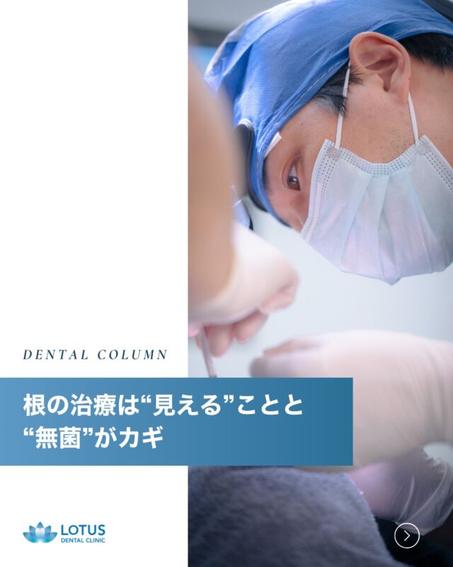 🦷 根の治療は“見える”ことと“無菌”がカギ！
「何度も根の治療をしたのに、また痛くなる…」
そんな経験はありませんか？

LOTUS DENTAL CLINIC 不動前では、
再発させないための“精密な根管治療”にこだわっています。

✓ 成功のポイントは“無菌化”と“見える化”
歯の根の中は非常に複雑で、ミクロン単位で枝分かれ・湾曲しています。
そのため、肉眼だけでは不十分なことも。

当院では、
✔ 高精度CTで根の形態を正確に診断
✔ マイクロスコープを使用して拡大視野で治療
✔ ラバーダム防湿で唾液や細菌の侵入をブロック
✔ 根の中を徹底的に洗浄・消毒して再感染を予防

「しっかり治して、再発しないようにしたい」
そんな思いに応える、丁寧で安心できる根の治療を行っています。
気になる症状がある方は、ぜひ一度ご相談ください。

・・・・・・・・・・

📍 LOTUS DENTAL CLINIC 不動前
🏡 東京都品川区西五反田3丁目13-11
🚶‍♀️ 不動前駅 徒歩2分／目黒駅 徒歩10分

#lotusdentalclinic #根管治療 #マイクロスコープ治療 #精密根管治療
#歯科CT #再発しない治療 #ラバーダム防湿 #虫歯治療 #歯科医院 #品川区 #不動前