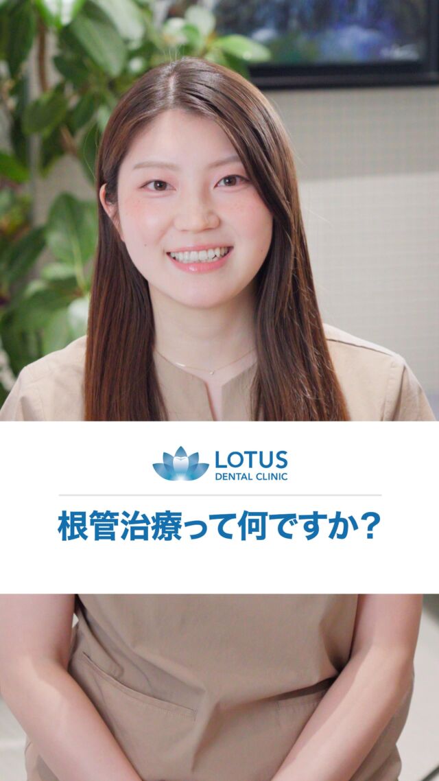根管治療（こんかんちりょう）って何ですか？

根管治療とは、歯の内部の「歯髄」と呼ばれる神経や血管組織が、虫歯などで炎症を起こした場合、それを取り除く治療です。歯髄は「根管」という細い管の中にあります。根管内の細菌や汚れを取り除き、再び感染が起きないように消毒して、最終的に薬剤で密閉します。治療のあとには、土台を作って、かぶせ物などで歯の形を回復させます。

つまり、「歯の中を治療して、歯を抜かずに守る治療」になります。