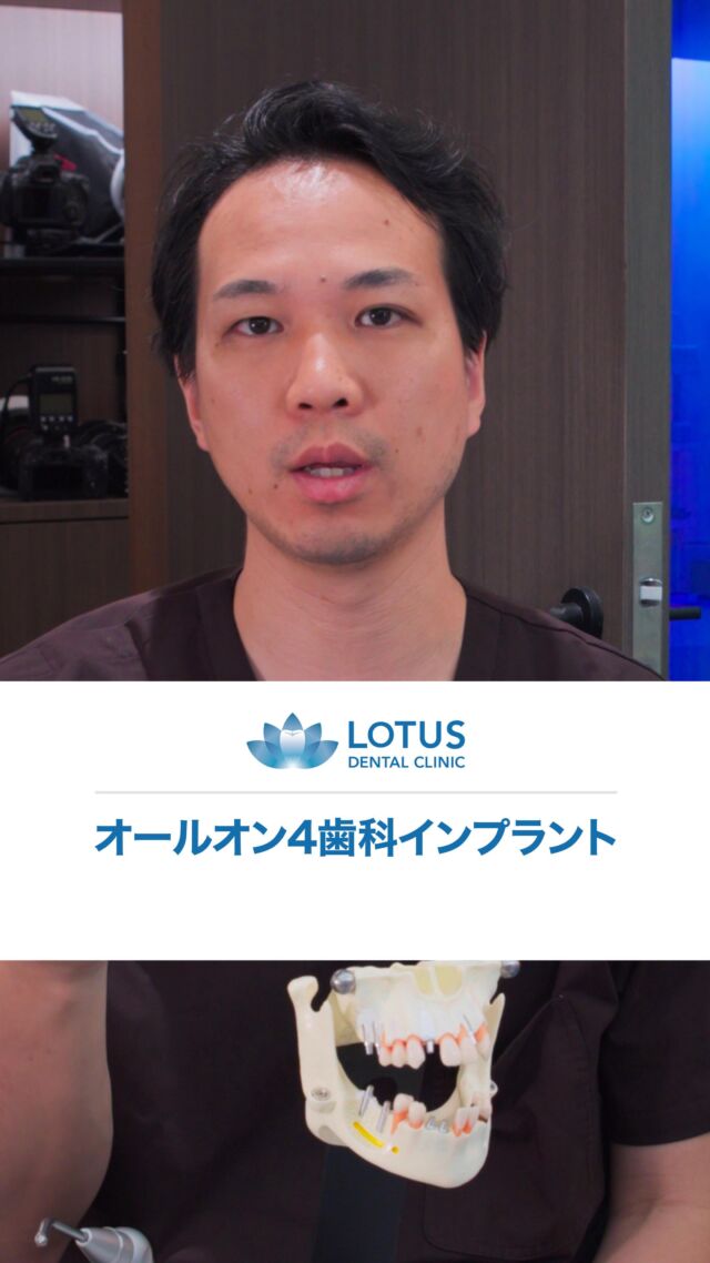 オールオン4歯科インプラント

All-on-4 dental implants

人の歯は２８本ありますので、全部無くなってしまった場合は２８本インプラントを入れるのかというと、そうではなくて少ない本数例えば４本とか６本とか８本で全体的なインプラント治療をすることができます。

A person has 28 teeth, so if they are all lost, it is not necessary to insert 28 implants.Instead, complete implant treatment can be performed with a smaller number of teeth, for example four, six, or eight.

📍 LOTUS DENTAL CLINIC 不動前

🏡 東京都品川区西五反田3丁目13-11

🚶‍♀️ 不動前駅 徒歩2分／目黒駅 徒歩10分

#歯科治療
#インプラント
#不動前歯科
#五反田歯科
#品川歯科